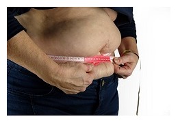 La dénutrition, colocataire de l'obésité