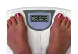 L'obésité : Définition, causes, et conséquences sur la santé